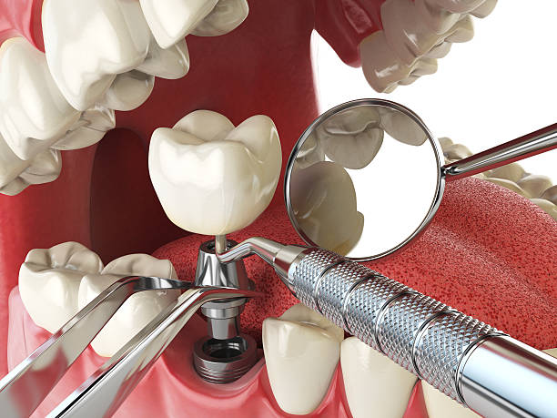 Best 24-Hour Emergency Dentist in Queen Anne, MD